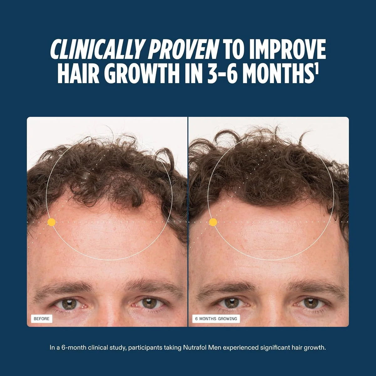 Nutrafol Men Hair Growth Supplement 120 Capsules