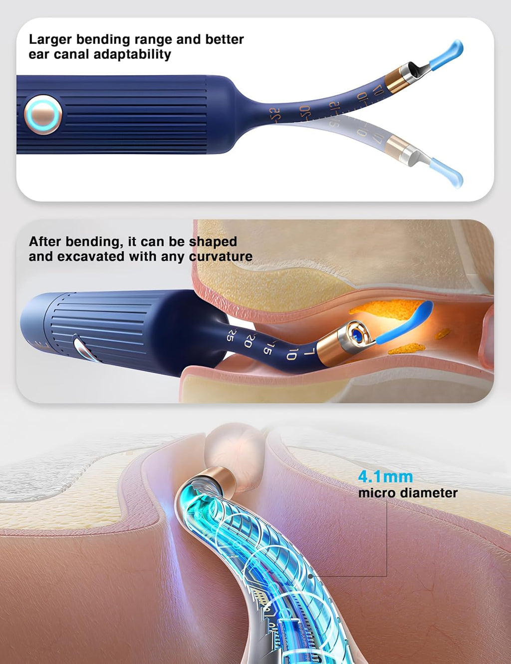 PeekClean™ HD Ear Camera – Stop Cleaning Blind | WiFi Visual Earwax Removal Kit